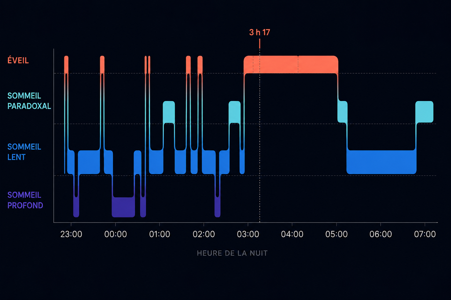 Courbe des phases de sommeil montrant une période d’éveil prolongée autour de 3 h du matin